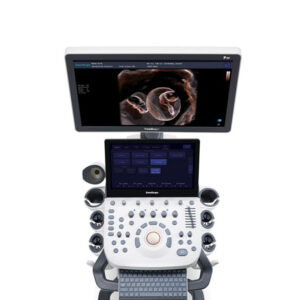 Ecógrafo estacionario P20