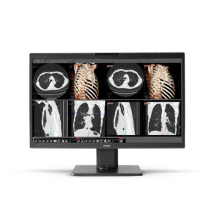 Monitor de referencia clínica Eonis Color de 8MP MDRC-8132