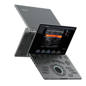 SonoAir 30-Chison