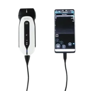 SonoEye P2 VET​-Chison
